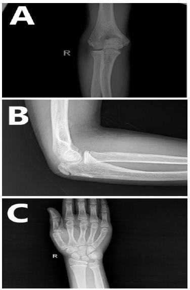 fig 4